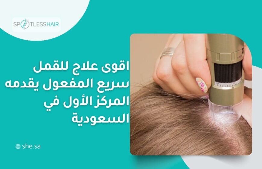 اقوى علاج للقمل سريع المفعول