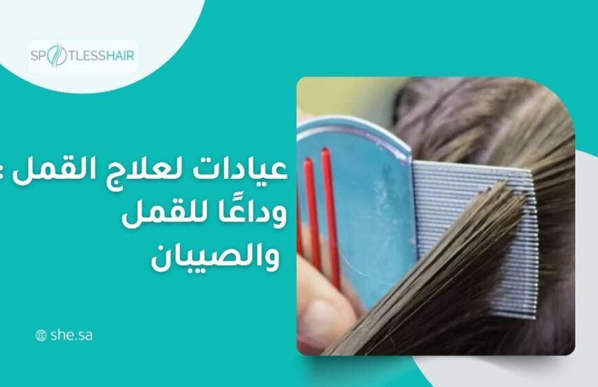 عيادات لعلاج القمل