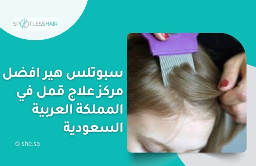 مركز علاج قمل