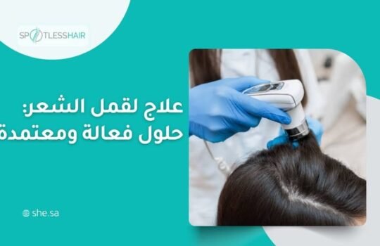 علاج لقمل الشعر