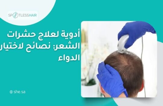 أدوية لعلاج حشرات الشعر