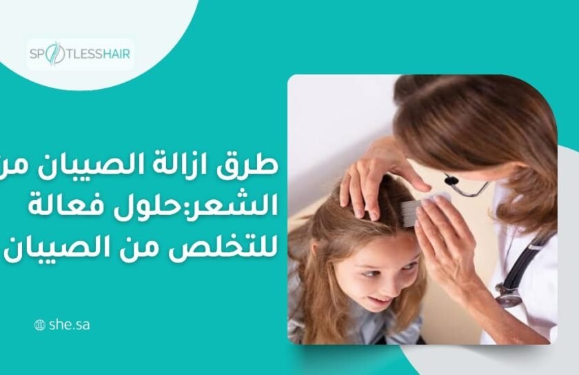 طرق ازالة الصيبان من الشعر