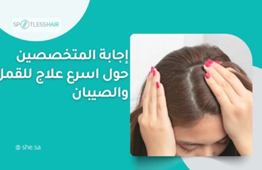 اسرع علاج للقمل والصيبان