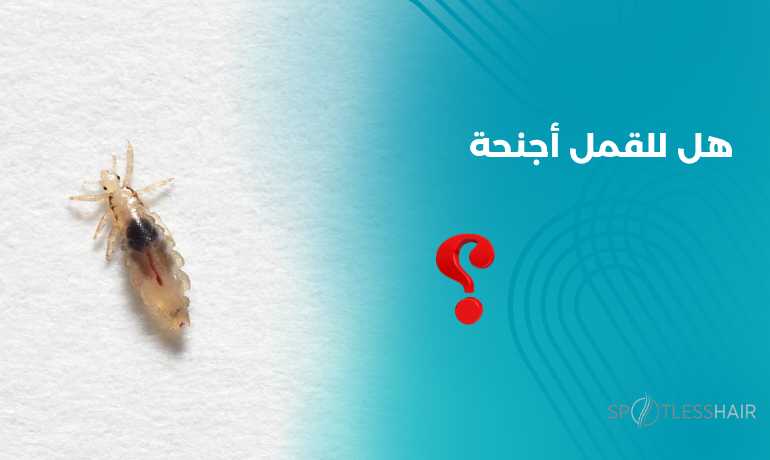 صورة توضح قملة صغيرة بدون أجنحة ، لتوضيح أن القمل لا يطير بل ينتقل بالتلامس المباشر – مركز سبوتلس هير