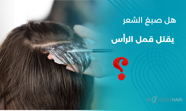هل صبغ الشعر يقتل قمل الرأس – علاج القمل بدون صبغة