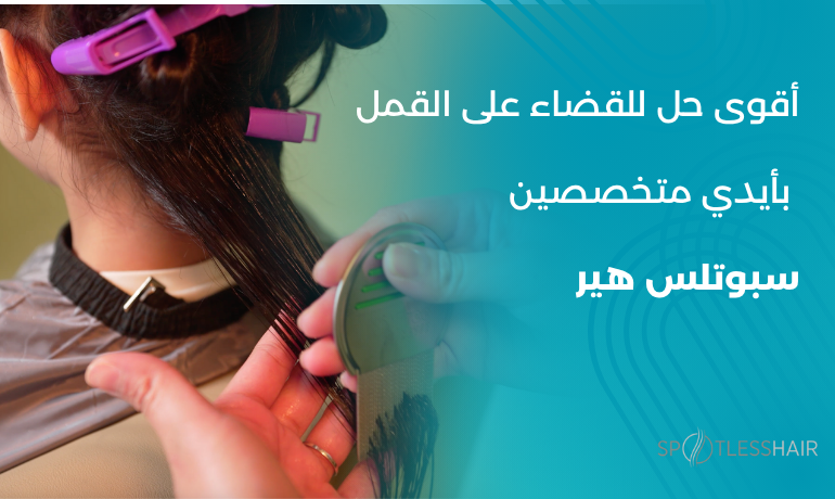 اخصائية في مركز سبوتلس هير وتقوم بتقديم علاج القمل، بيئة نظيفة وآمنة لإزالة القمل بدون مواد كيميائية.