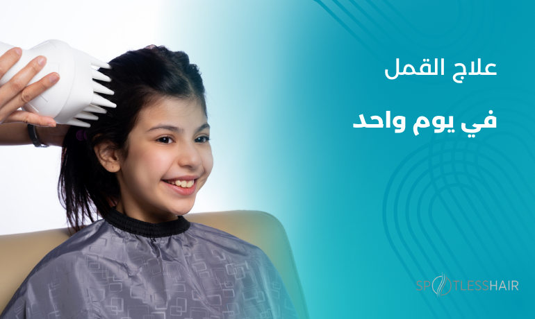 علاج القمل في يوم واحد