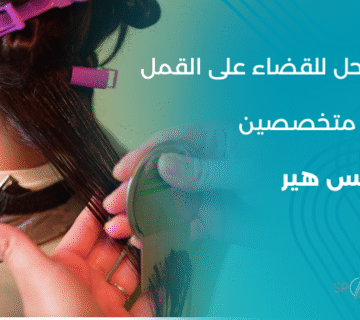 أقوى حل للقضاء على القمل و إزالة القمل بدون مواد كيميائية في مركز سبوتلس هير. وذلك باستخدام جهاز طبي معتمد بدون استخدام اي مواد كيميائية ضارة.