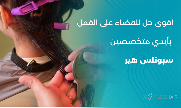 أقوى حل للقضاء على القمل و إزالة القمل بدون مواد كيميائية في مركز سبوتلس هير. وذلك باستخدام جهاز طبي معتمد بدون استخدام اي مواد كيميائية ضارة.