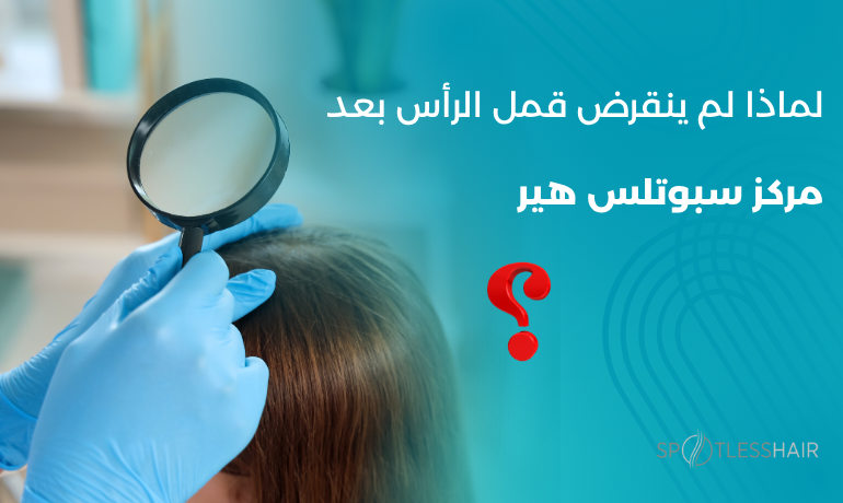 صورة مكبّرة تُظهر قملة على خصلة شعر مع توضيح دورة حياتها ومقاومتها للمبيدات، تعبير عن القمل الخارق الذي لم ينقرض – مركز سبوتلس هير.