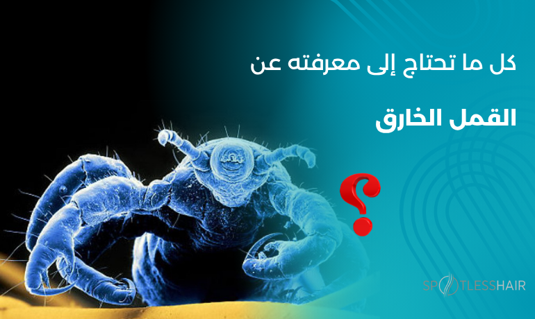 صورة مكبرة تُظهر قملة على خصلة شعر تحت عدسة مجهرية، توضح شكل القمل الخارق المقاوم للعلاجات التقليدية، مع شعار مركز سبوتلس هير للعلاج الآمن