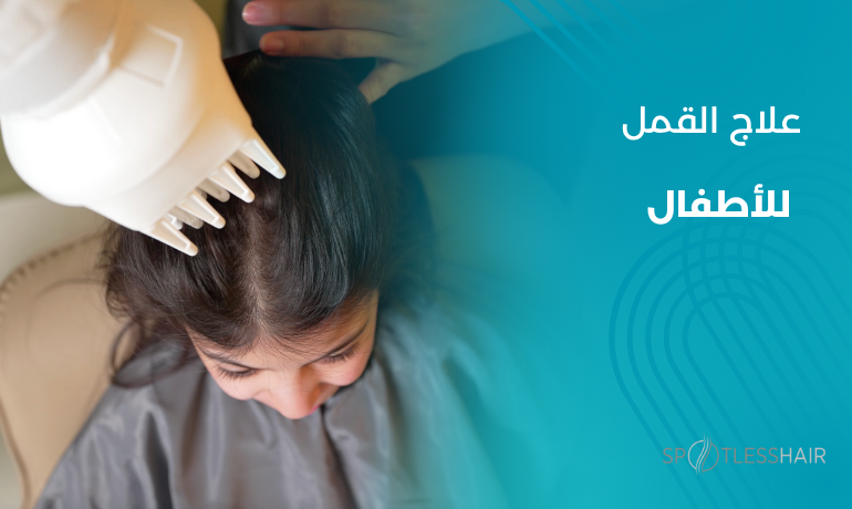 علاج القمل للأطفال: الحل الطبيعي والآمن