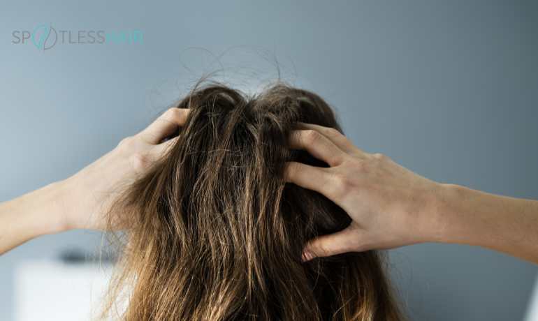 حكة فروة الرأس كأحد أعراض الإصابة بالقمل 