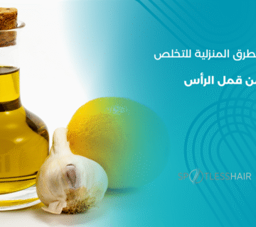 الطرق المنزلية للتخلص من القمل