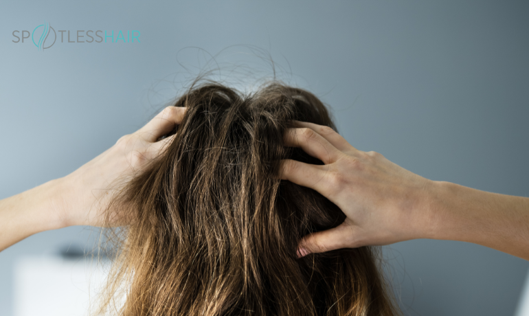 حكة فروة الرأس كأحد أعراض الإصابة بالقمل.