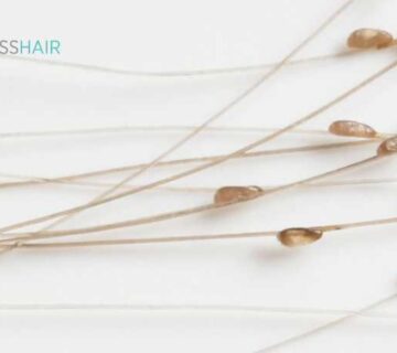 كيف أعرف أن بيض القمل ميت؟ وماهو شكل الصيبان في الشعر