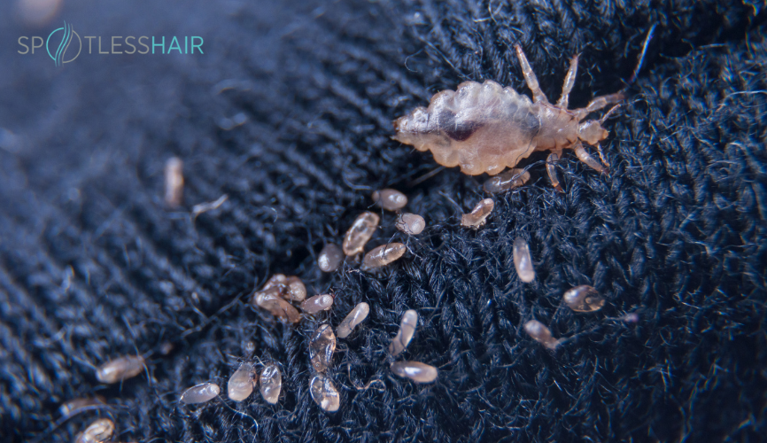 شكل قمل الجسم في الملابس