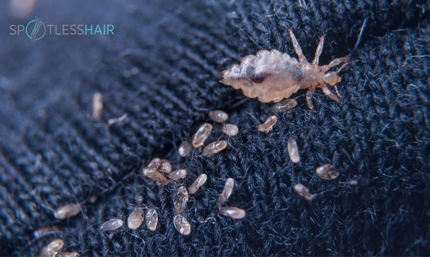 شكل قمل الجسم في الملابس