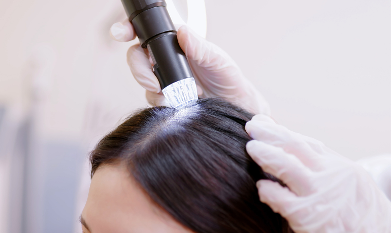 فحص فروة الرأس باستخدام كاميرا دقيقة داخل عيادة متخصصة للكشف المبكر عن القمل ومعرفة تأثير القمل على الشعر