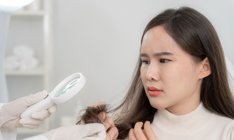 فحص حالة الشعر لتوضيح تأثير القمل على مظهر الشعر مع الوقت.