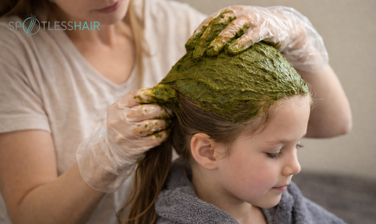 هل السِّدر أو الحناء تقتل القمل؟ وماهو تأثير الحناء على القمل والصيبان.