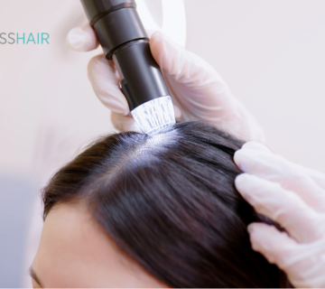 Scanning the scalp with a micro camera in a specialized clinic for early detection of lice and knowing the damage of lice to the hair