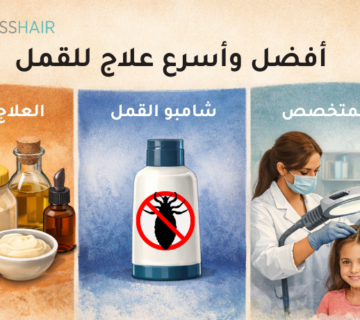 أفضل وأسرع علاج للقمل: مقارنة بين الطرق المنزلية والعلاج المتخصص