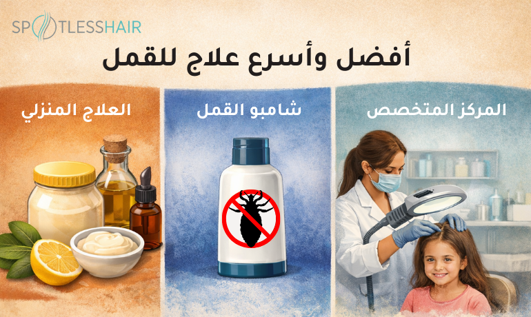 أفضل وأسرع علاج للقمل: مقارنة بين الطرق المنزلية والعلاج المتخصص