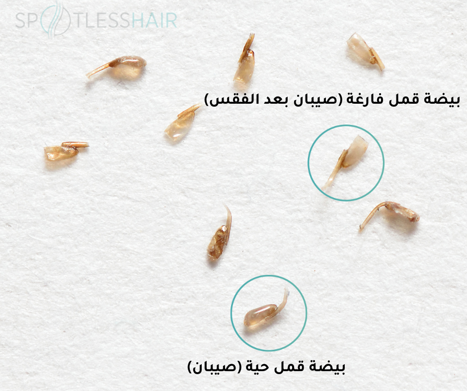 1 استخدام الشامبو بلّلي شعر طفلك جيدًا، ثم ضعي كمية مناسبة من الشامبو ووزّعيه على فروة الرأس حتى الأطراف اتركيه لمدة 3 إلى 5 دقائق 12