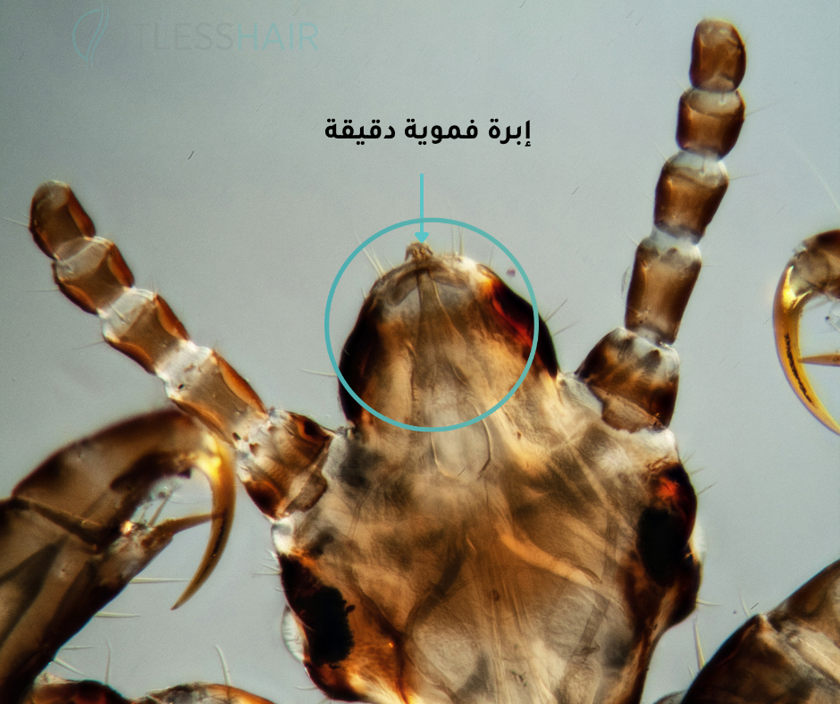 كيف يتغذى القمل