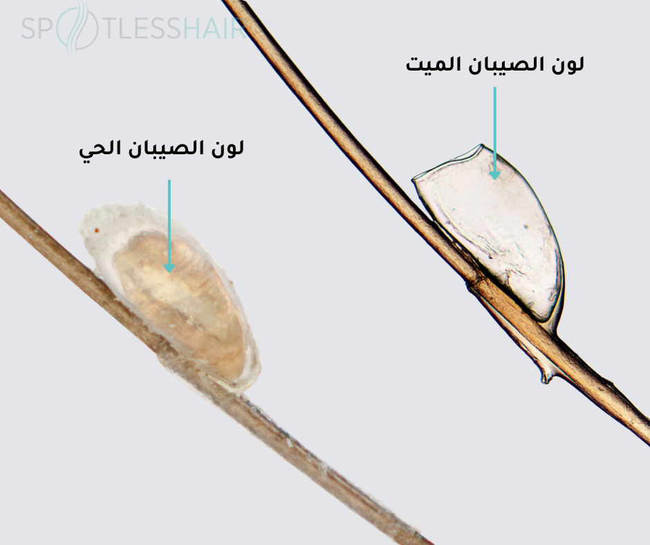 الفرق بين لون الصيبان الميت والحي