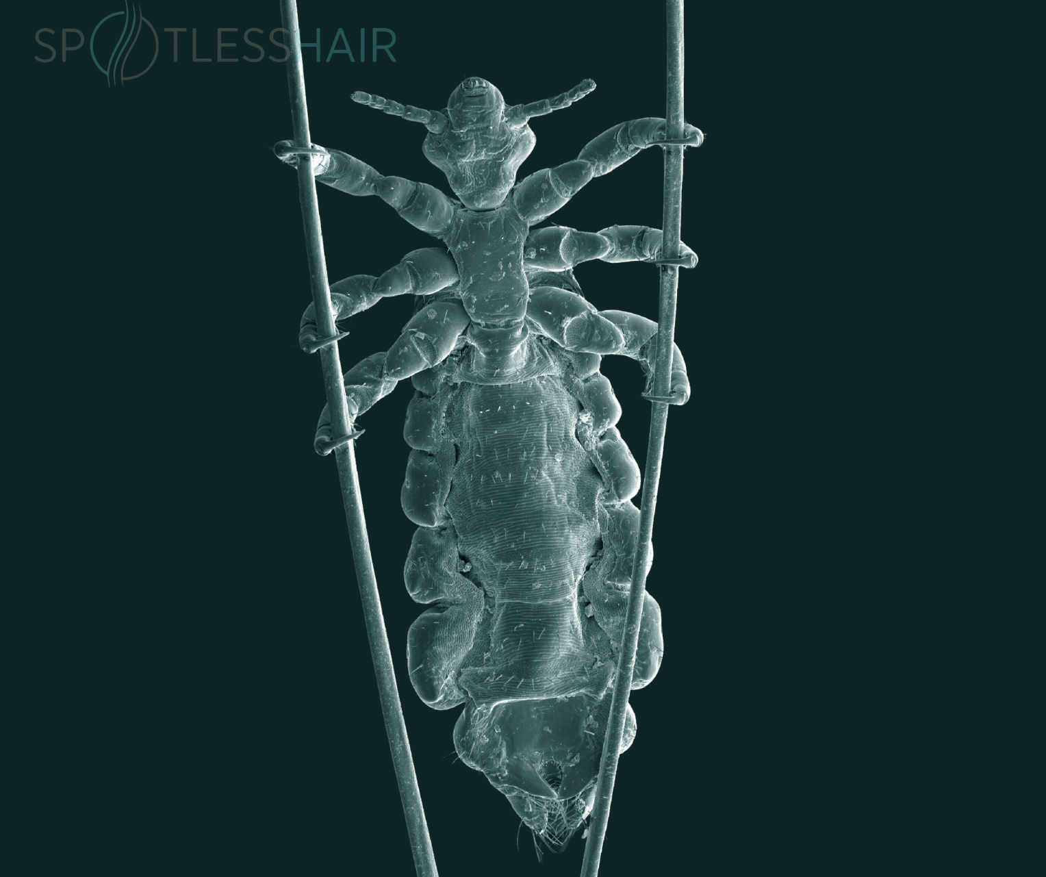 1 استخدام الشامبو بلّلي شعر طفلك جيدًا، ثم ضعي كمية مناسبة من الشامبو ووزّعيه على فروة الرأس حتى الأطراف اتركيه لمدة 3 إلى 5 دقائق 4