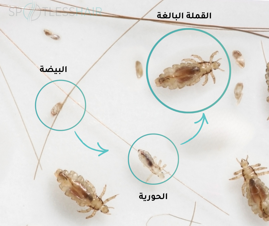 دورة حياة القمل