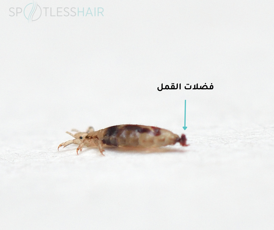 فضلات القمل