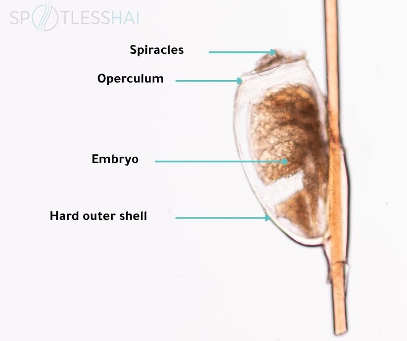Lice eggs anatomy