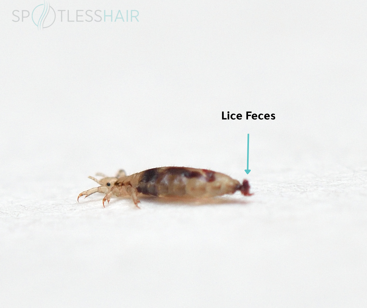 Do Lice Excrete Waste