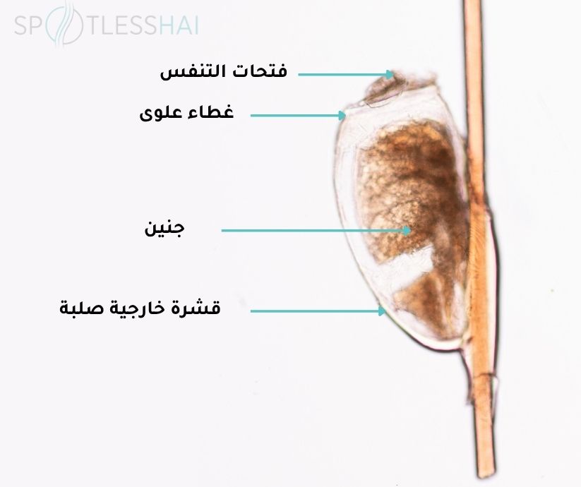 مما يتكون بيض القمل (الصيبان )