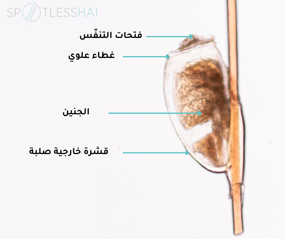 مما يتكون بيض القمل (الصيبان )