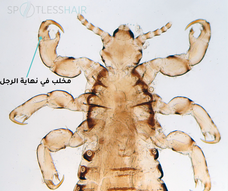 تركيب ارجل القملة