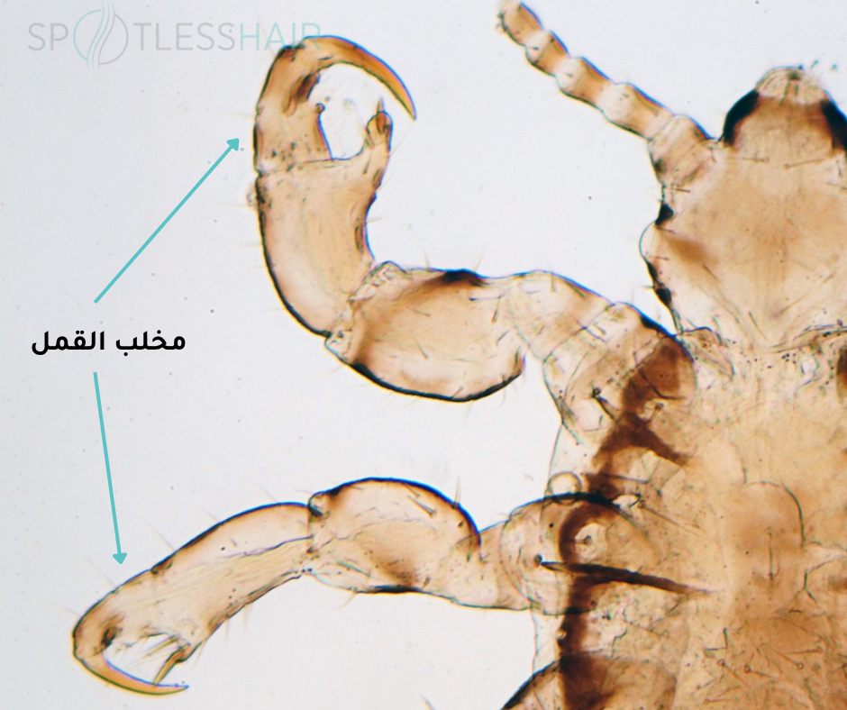 مخالب للمساعدة في الحركة والتنقل