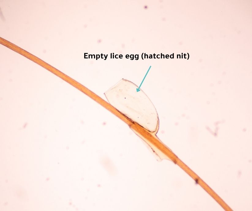 Empty Nits