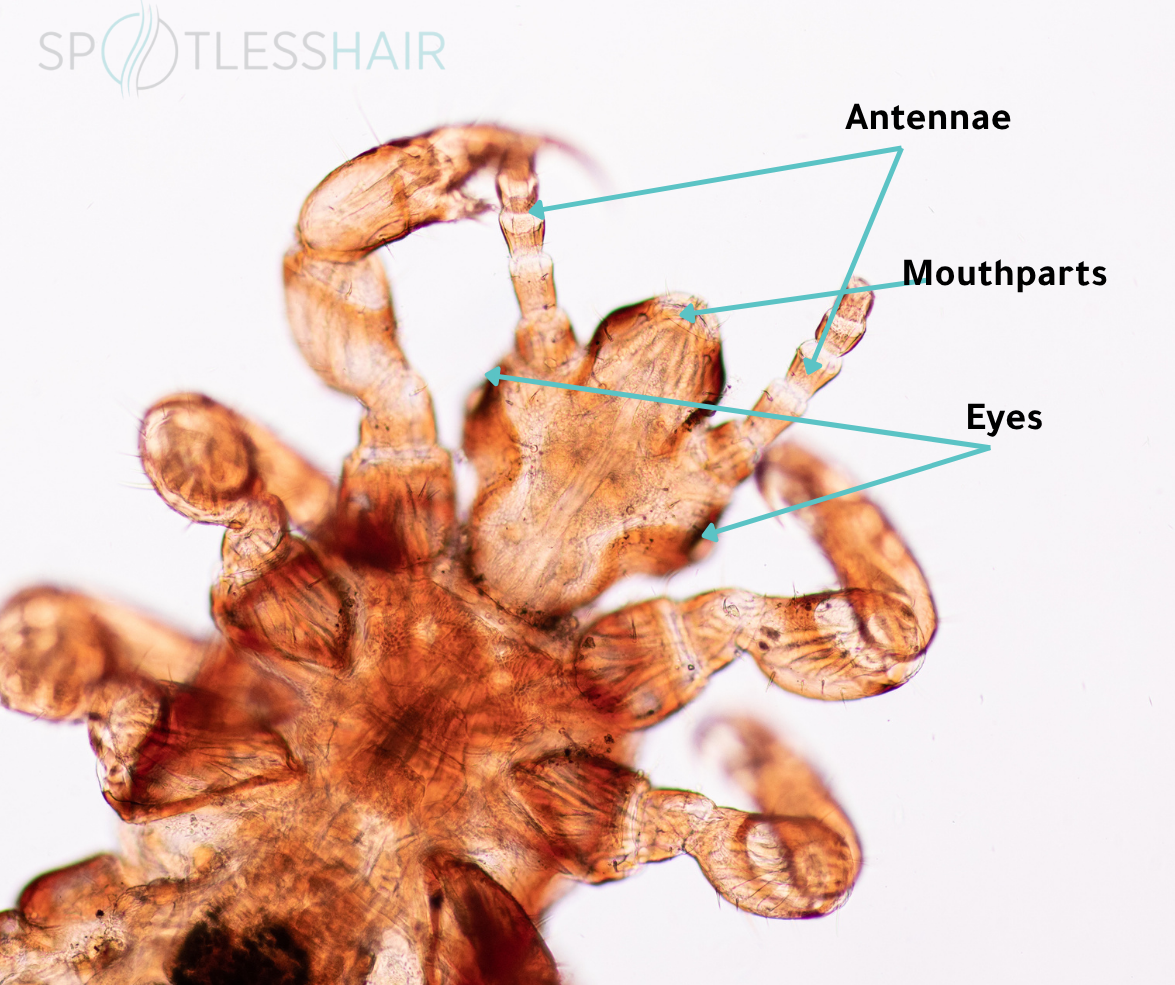 Head Structure of Head Lice