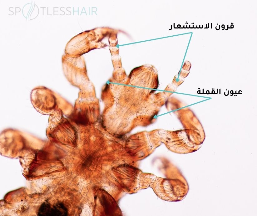 كيف يعيش القمل
