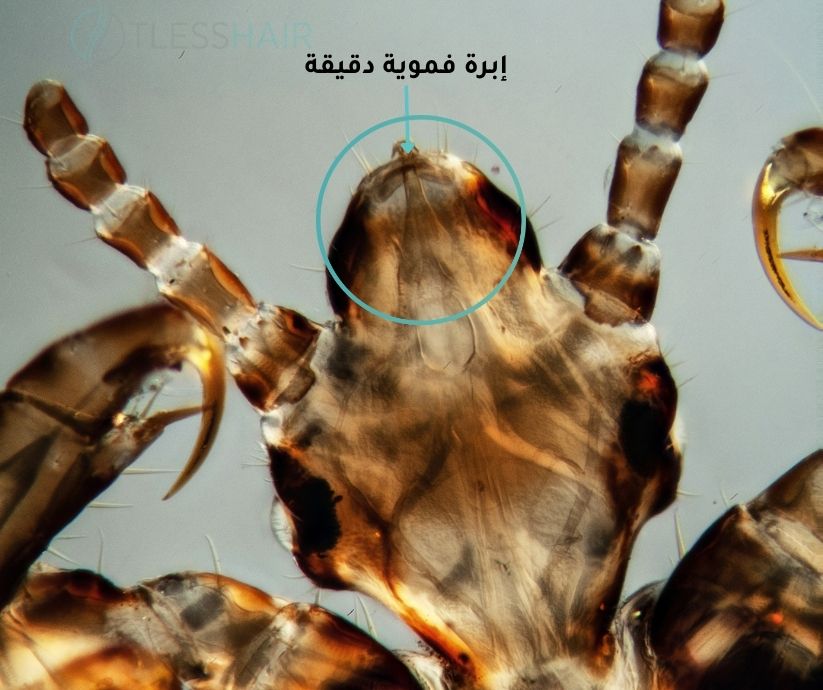 كيف يتغذى القمل بالصور