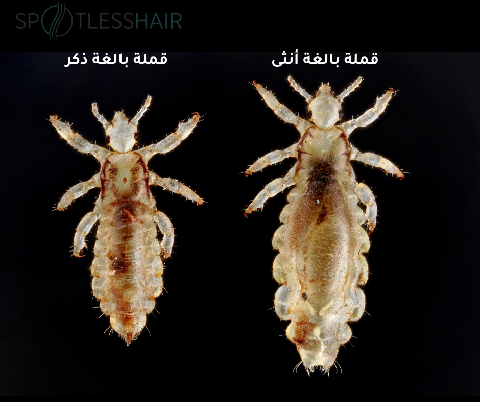 الفرق بين القملة الأنثى والذكر