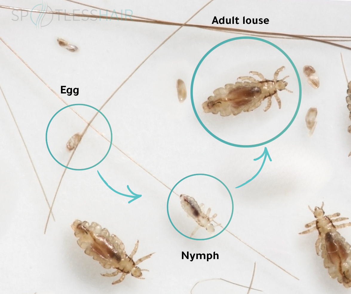 Lice Life Cycle Stages