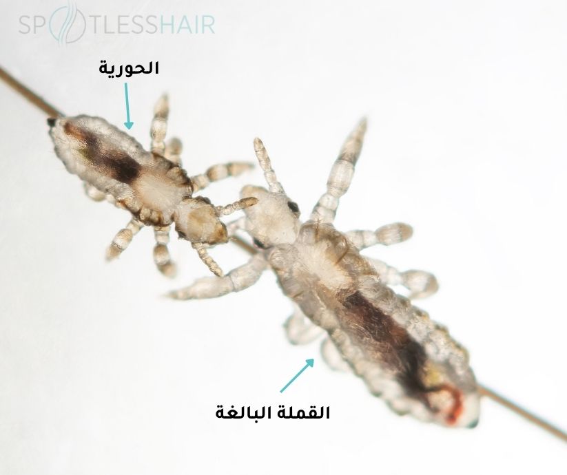 الفرق بين القملة الحورية والقملة البالغة