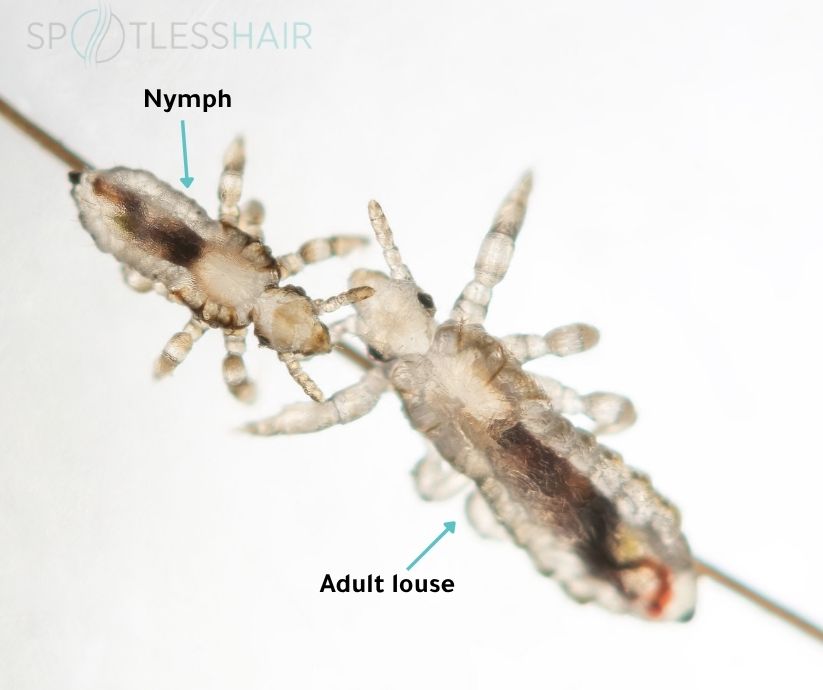 The Difference Between Nymph Lice and Adult Lice