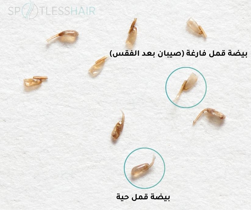 الفرق بين الصيبان الحي والفاقس