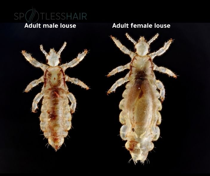 Lice Life Cycle Explained: From Nits to Adult Lice